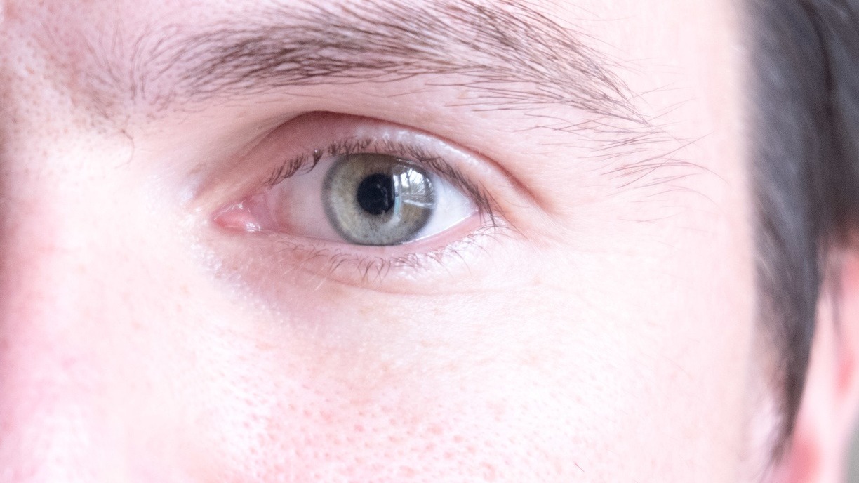 Глаза могут рассказать о сердечно-сосудистых заболеваниях: не пропускайте эти сигналы