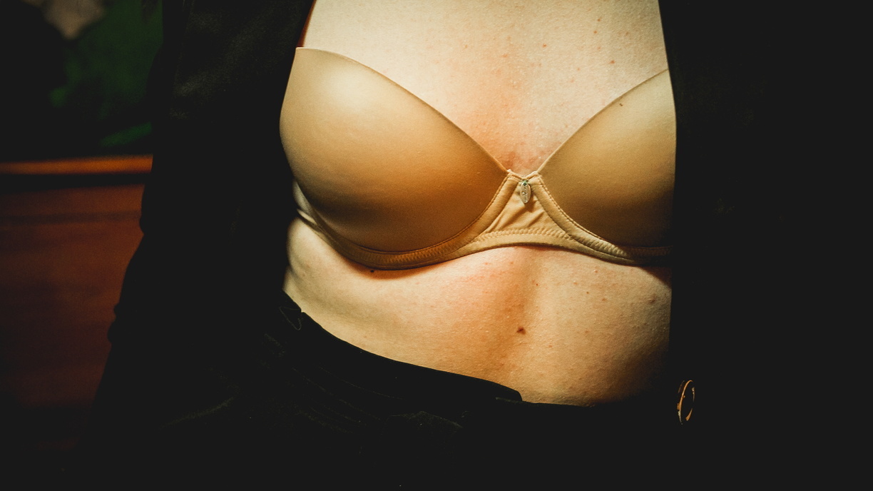 «Предопухолевое состояние»: женщин Владивостока зовут проверить грудь